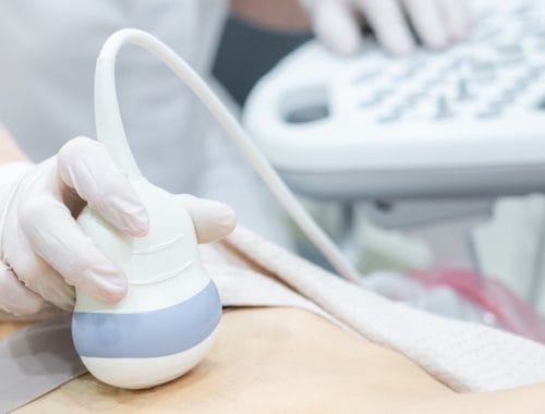 vodjenje pracenje i kontrola trudnoce