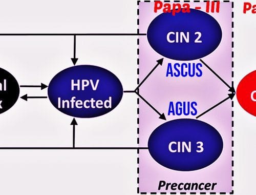 Kondilomi i HP Virus