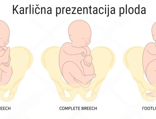 Karlična prezentacija ploda