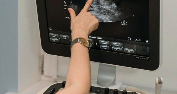 ginekoloski ultrazvuk