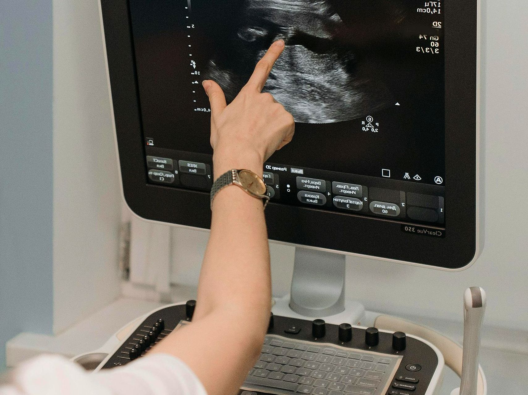 ginekoloski ultrazvuk